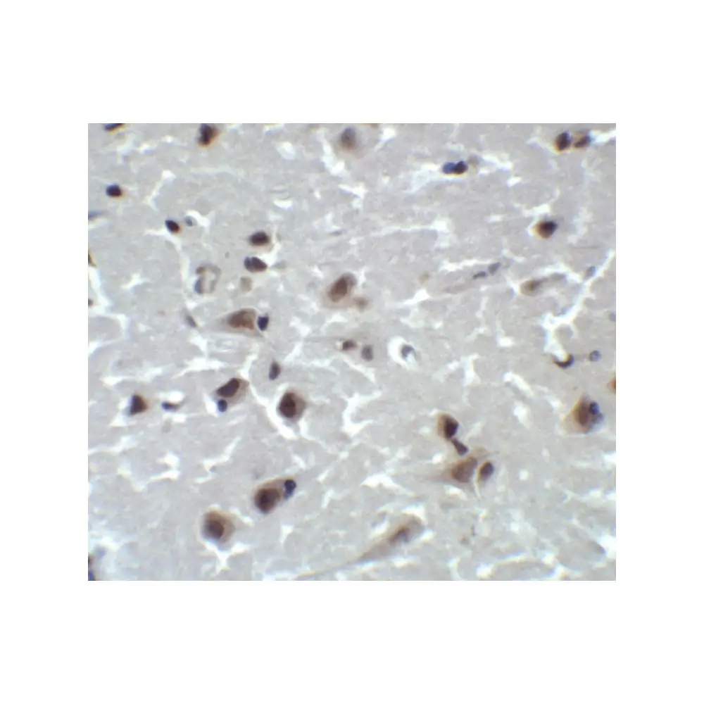 ProSci 5195 CD81 Antibody, ProSci, 0.1 mg/Unit Quaternary Image