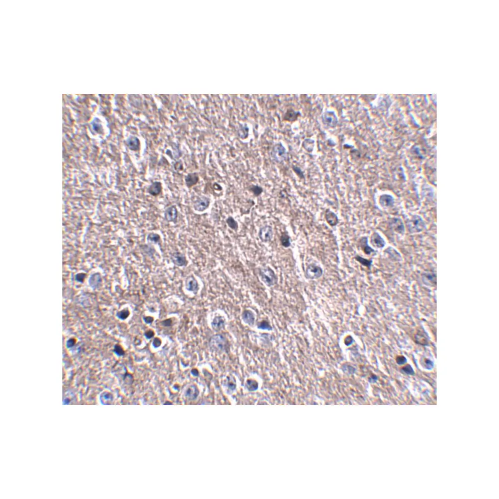 ProSci 5047_S CDIP Antibody, ProSci, 0.02 mg/Unit Secondary Image