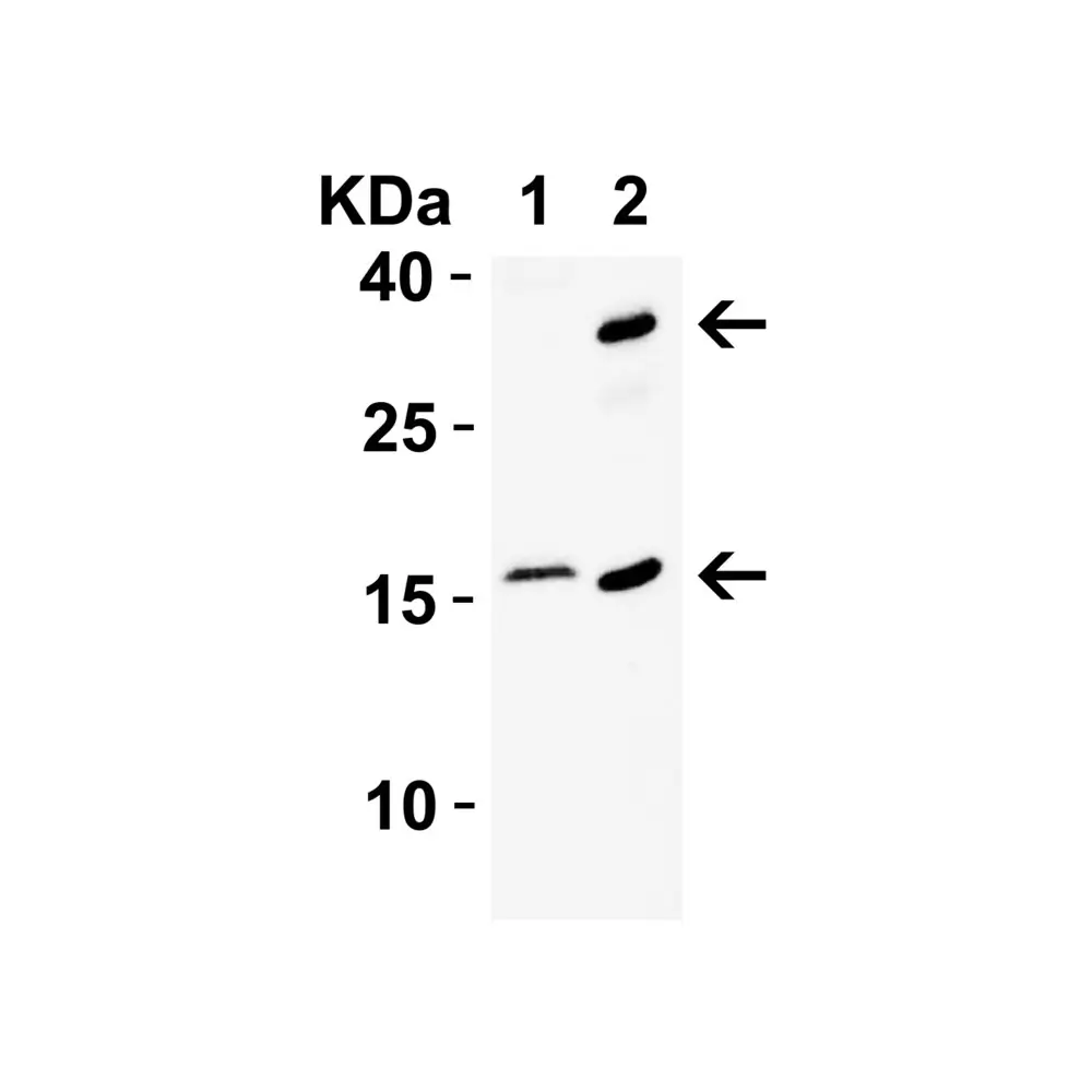 ProSci 4211 CDKN2A Antibody, ProSci, 0.1 mg/Unit Tertiary Image