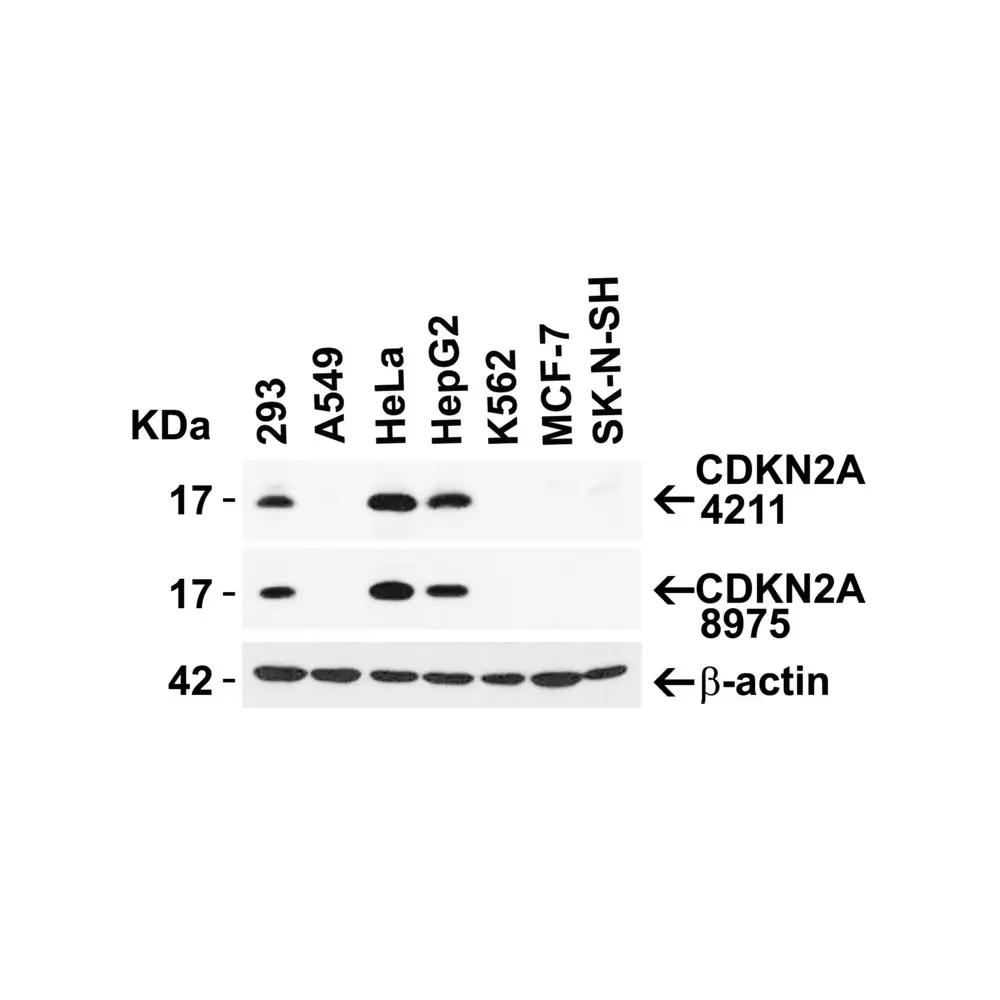 ProSci 4211_S CDKN2A Antibody, ProSci, 0.02 mg/Unit Secondary Image