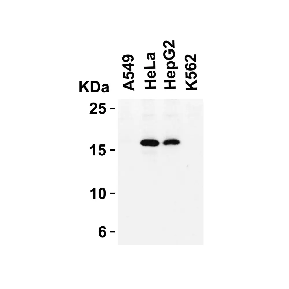 ProSci 4211 CDKN2A Antibody, ProSci, 0.1 mg/Unit Quaternary Image