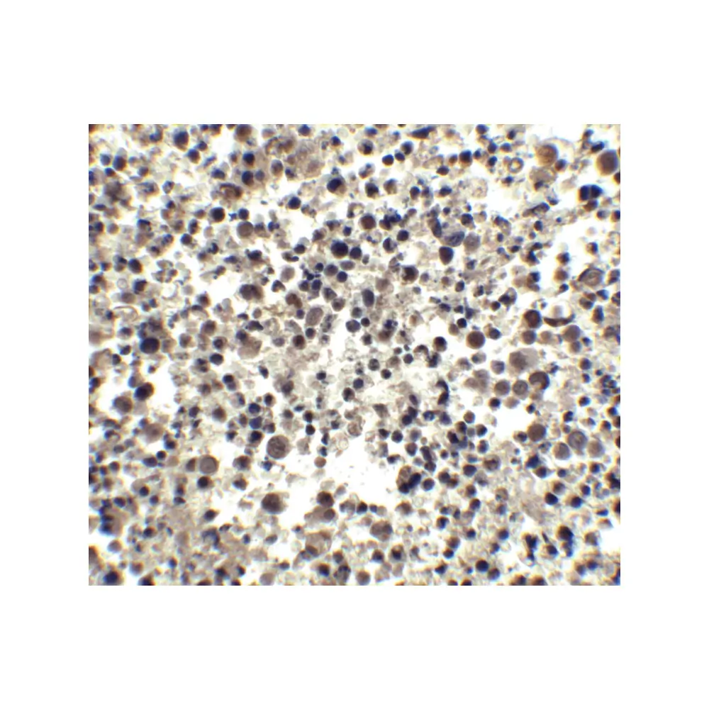 ProSci 2089 CIDE-A Antibody, ProSci, 0.1 mg/Unit Senary Image