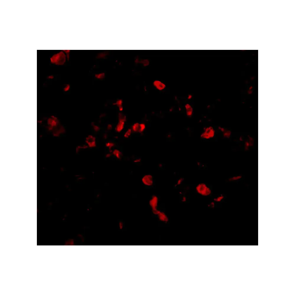 ProSci 2499 CIKS Antibody, ProSci, 0.1 mg/Unit Tertiary Image
