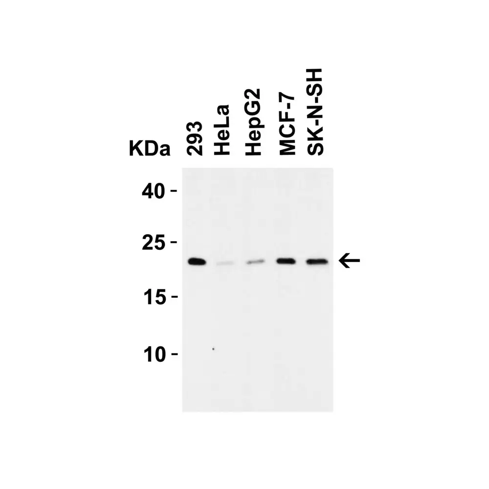 ProSci 7025_S CLAUDIN4 Antibody, ProSci, 0.02 mg/Unit Secondary Image