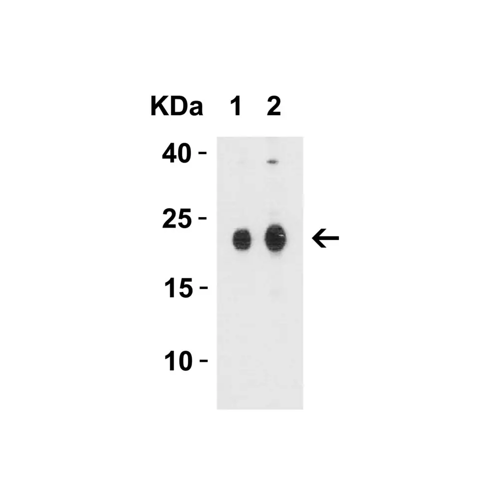 ProSci 7025_S CLAUDIN4 Antibody, ProSci, 0.02 mg/Unit Tertiary Image