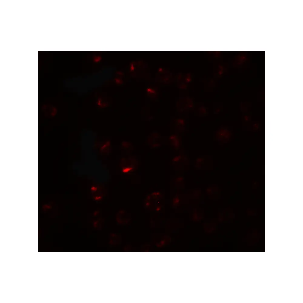 ProSci 6959 CLEC2A Antibody, ProSci, 0.1 mg/Unit Secondary Image