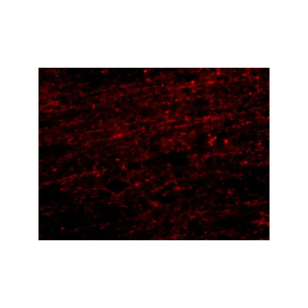 ProSci 4659 CLIP170 Antibody, ProSci, 0.1 mg/Unit Secondary Image