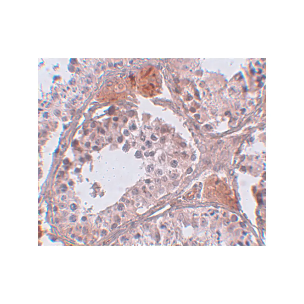 ProSci 5497 CLPH Antibody, ProSci, 0.1 mg/Unit Secondary Image