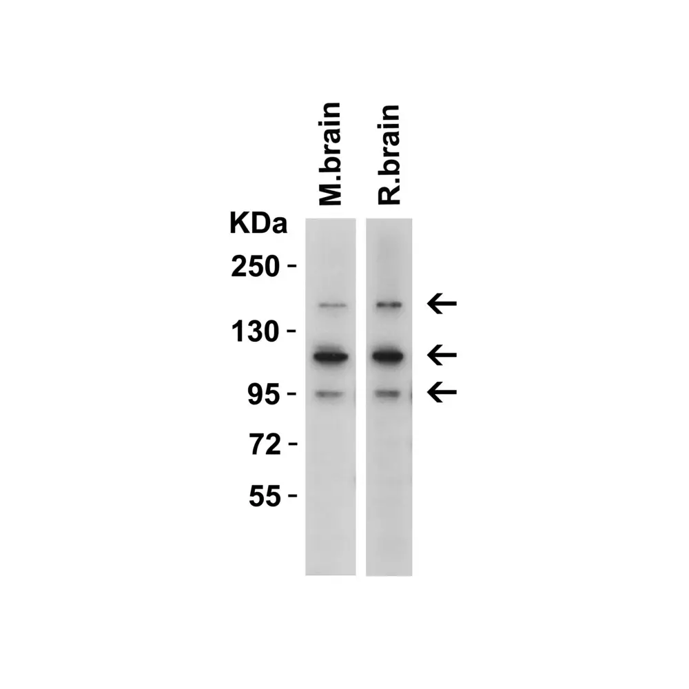 ProSci 7155 CRB2 Antibody, ProSci, 0.1 mg/Unit Secondary Image