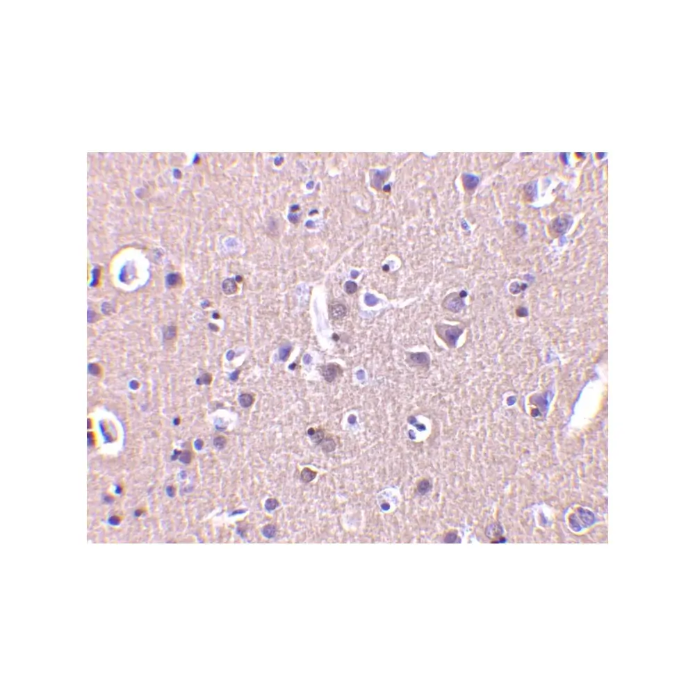 ProSci 3623 CRMP1 Antibody, ProSci, 0.1 mg/Unit Secondary Image