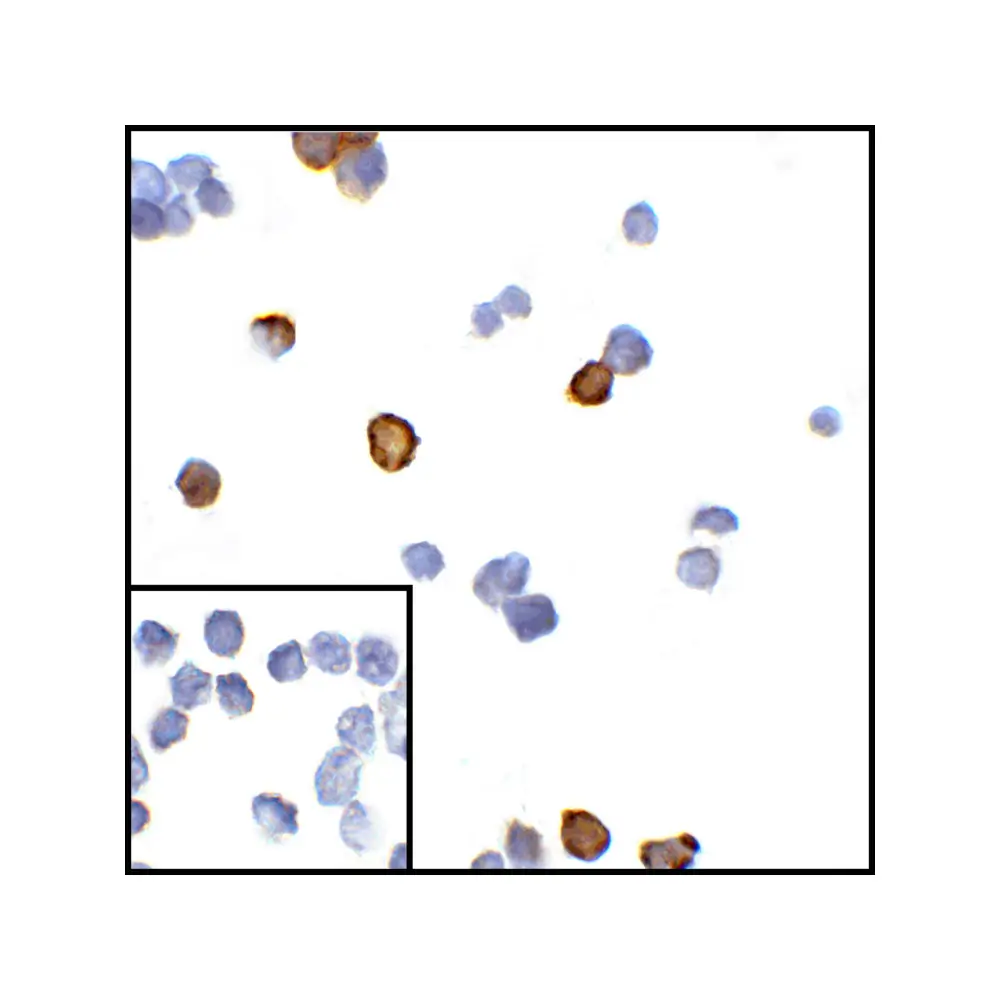 ProSci RF16013_S CTLA4 Antibody [8A1], ProSci, 0.02 mg/Unit Secondary Image