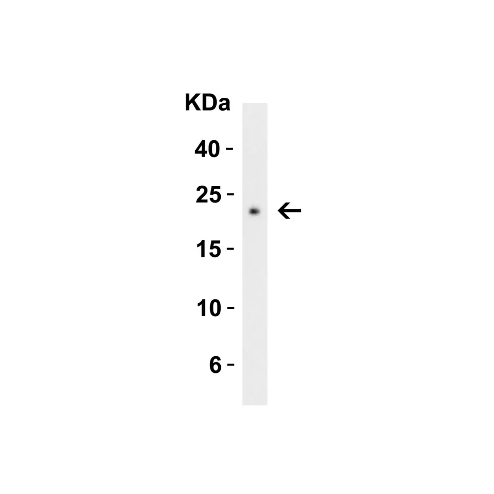 ProSci 3565 CTRP3 Antibody, ProSci, 0.1 mg/Unit Secondary Image