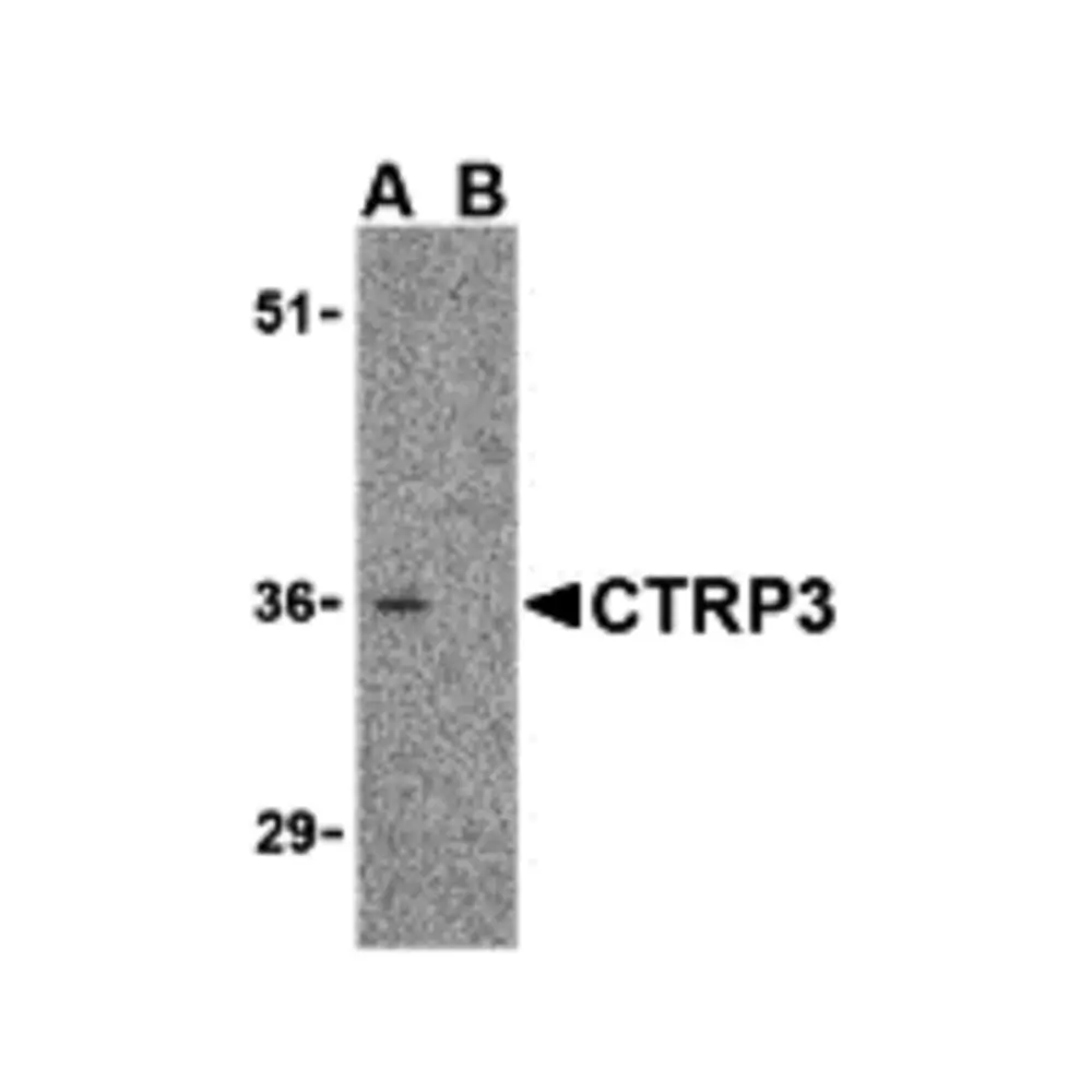 ProSci 3565 CTRP3 Antibody, ProSci, 0.1 mg/Unit Quaternary Image
