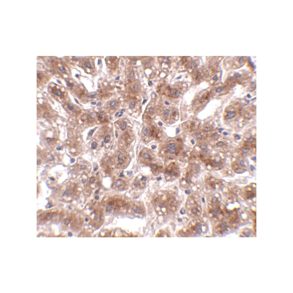 ProSci 4829_S CUEDC1 Antibody, ProSci, 0.02 mg/Unit Secondary Image