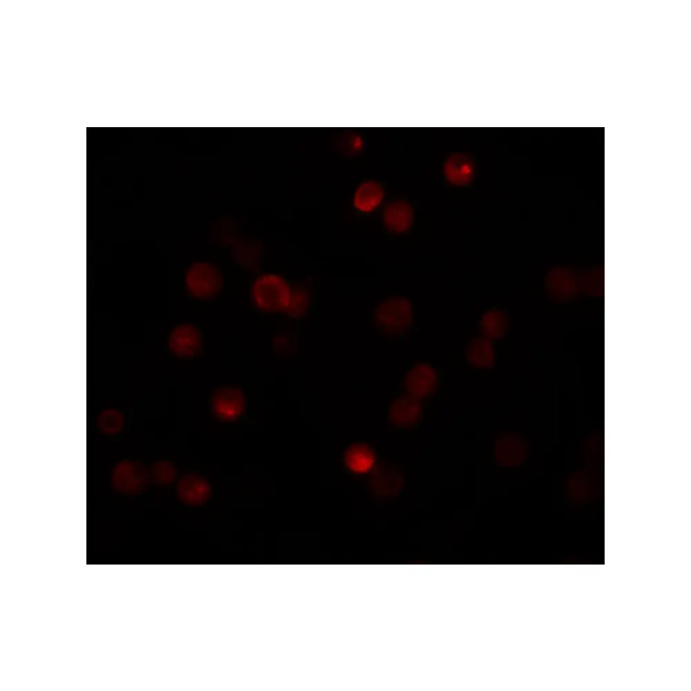 ProSci 5859_S CaBP7 Antibody, ProSci, 0.02 mg/Unit Tertiary Image
