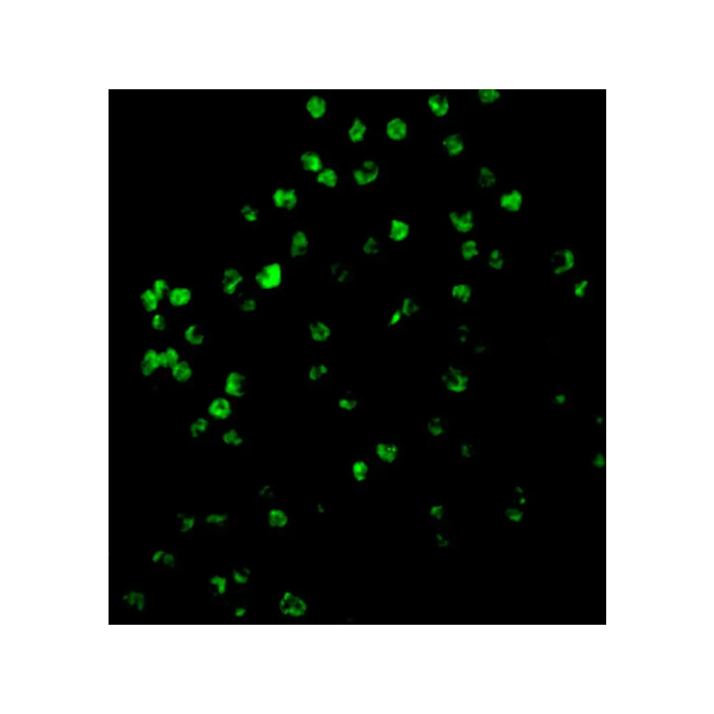 ProSci 3453_S Caspase-4 Antibody, ProSci, 0.02 mg/Unit Tertiary Image