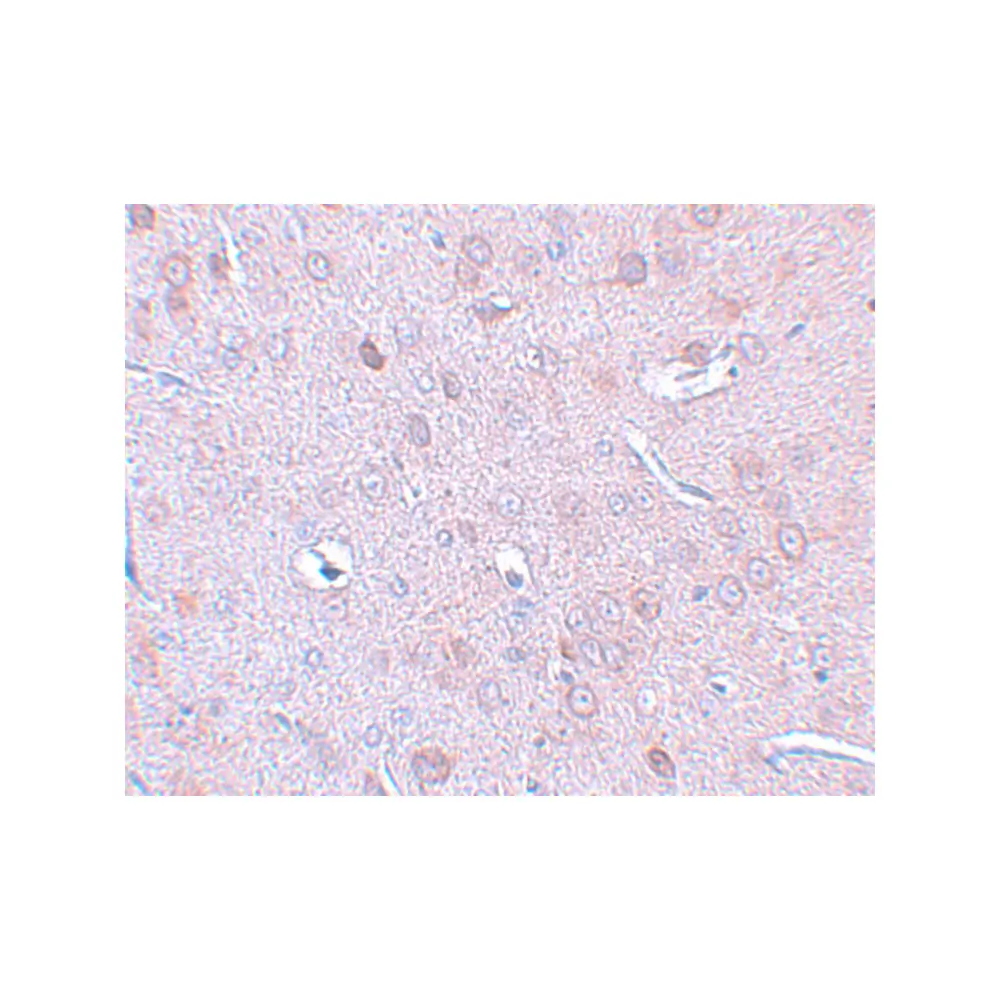 ProSci 5633 DCLK1 Antibody, ProSci, 0.1 mg/Unit Secondary Image