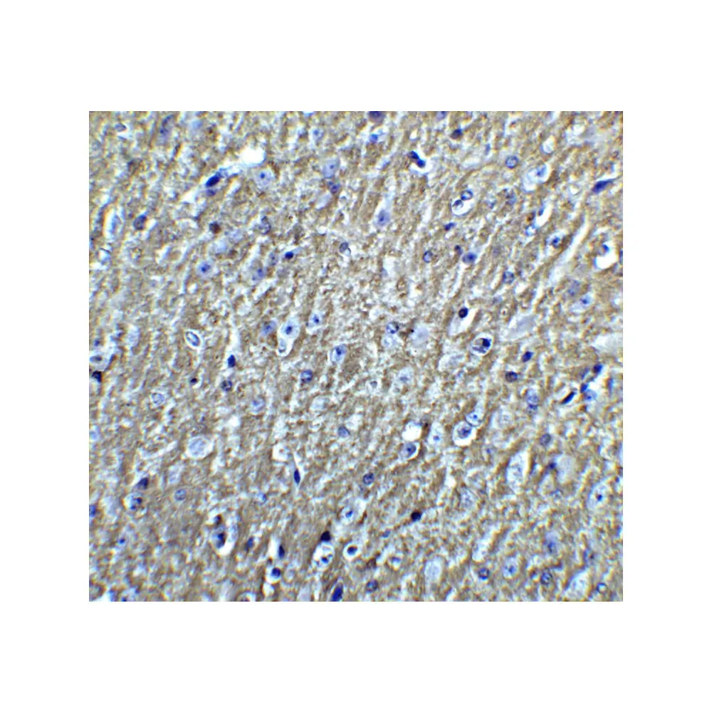 ProSci 5637_S DCLK3 Antibody, ProSci, 0.02 mg/Unit Tertiary Image