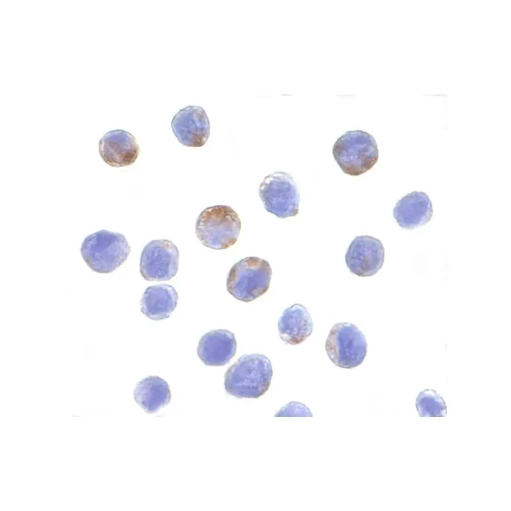 ProSci 3757 DDX3 Antibody, ProSci, 0.1 mg/Unit Secondary Image