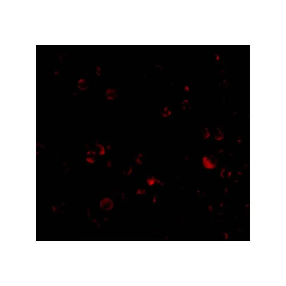 ProSci 3757_S DDX3 Antibody, ProSci, 0.02 mg/Unit Tertiary Image