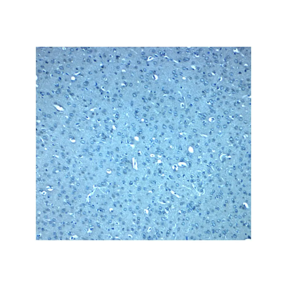 ProSci 8347 DIS3L2 Antibody, ProSci, 0.1 mg/Unit Secondary Image