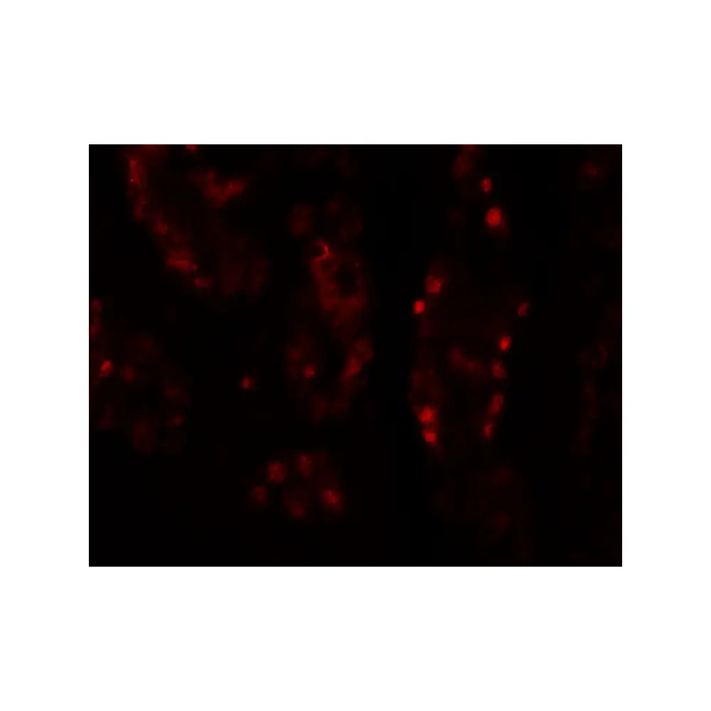 ProSci 6629 DISP1 Antibody, ProSci, 0.1 mg/Unit Tertiary Image