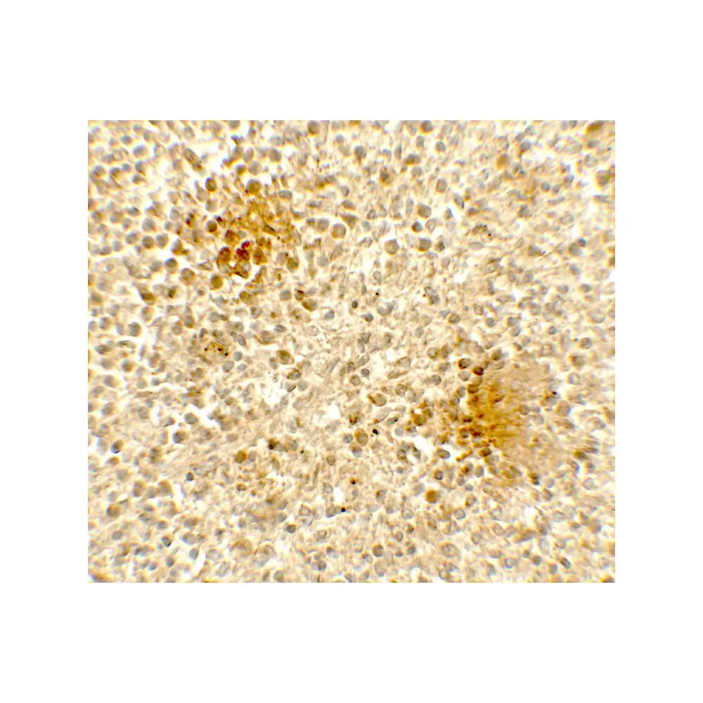 ProSci 7847_S DOCK8 Antibody, ProSci, 0.02 mg/Unit Secondary Image