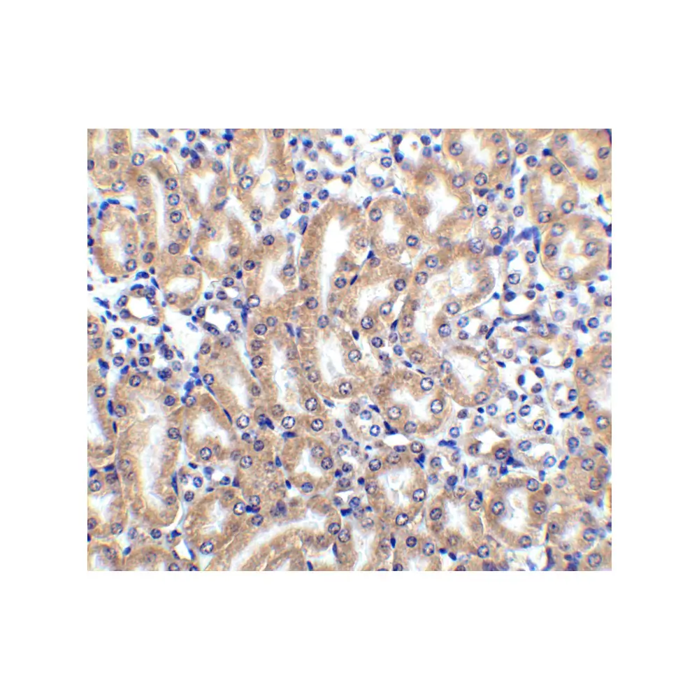 ProSci 2021 DcR2 Antibody, ProSci, 0.1 mg/Unit Tertiary Image