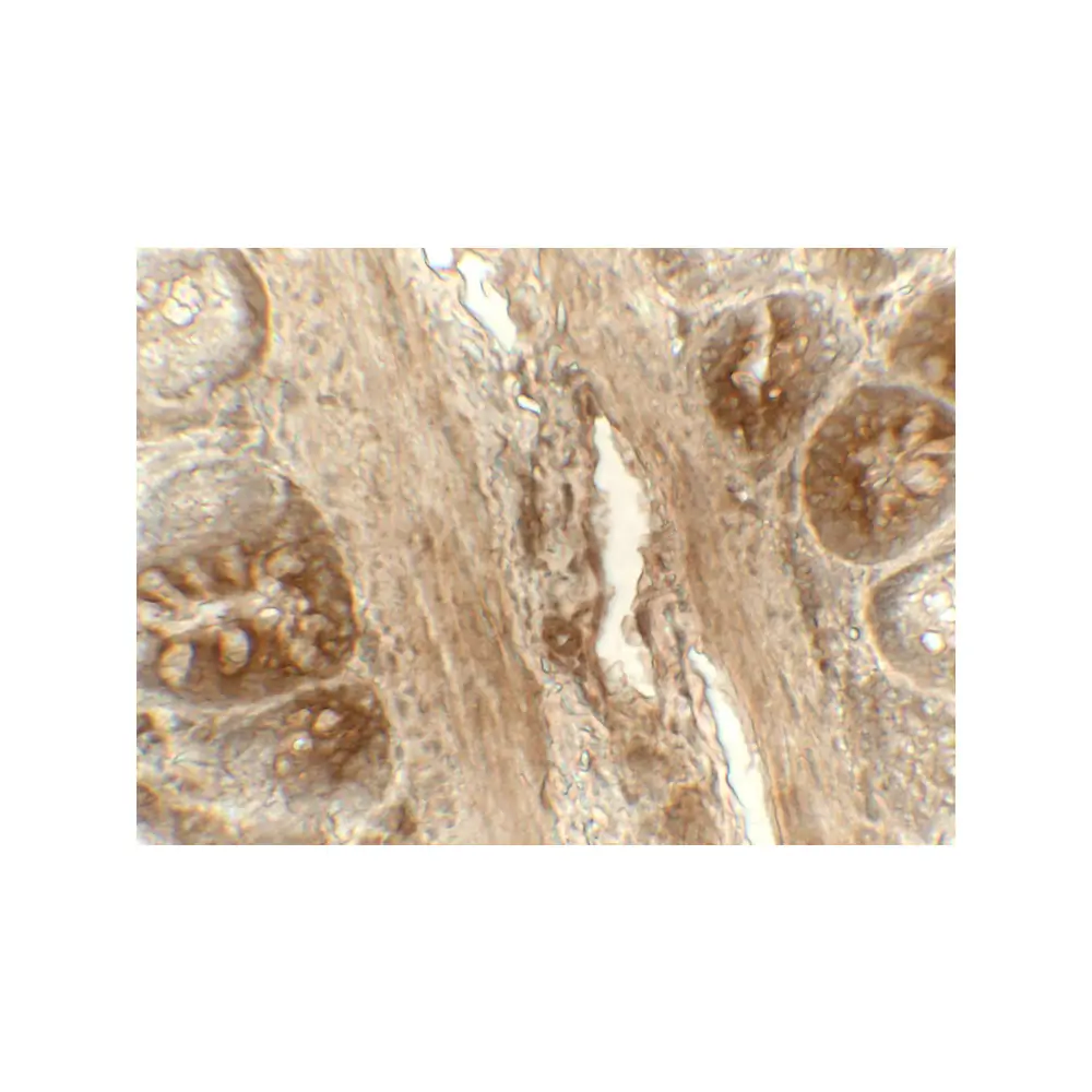 ProSci 8211_S ERp72 Antibody, ProSci, 0.02 mg/Unit Secondary Image