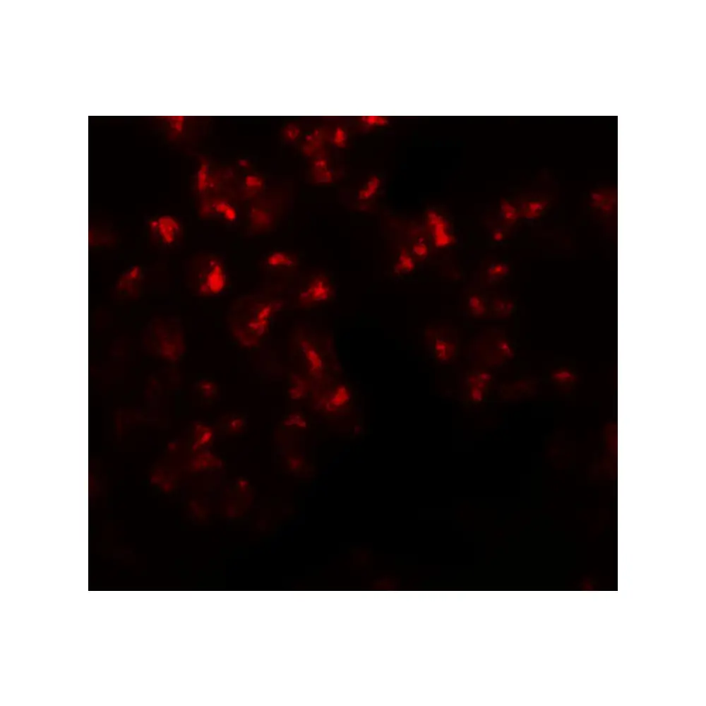 ProSci 6263 EZH2 Antibody, ProSci, 0.1 mg/Unit Tertiary Image