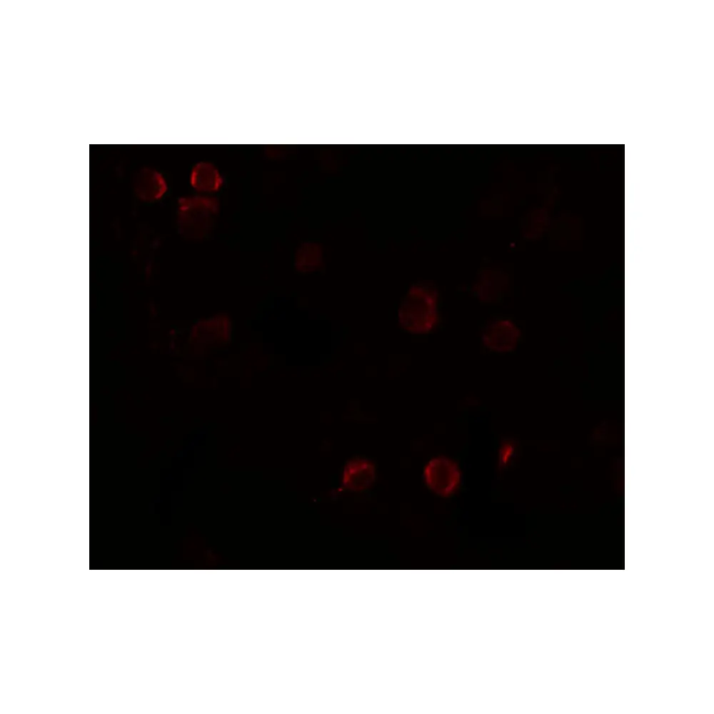 ProSci 5829 FREM1 Antibody, ProSci, 0.1 mg/Unit Tertiary Image