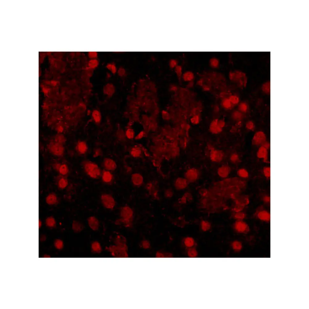 ProSci 5137_S FTO Antibody, ProSci, 0.02 mg/Unit Secondary Image