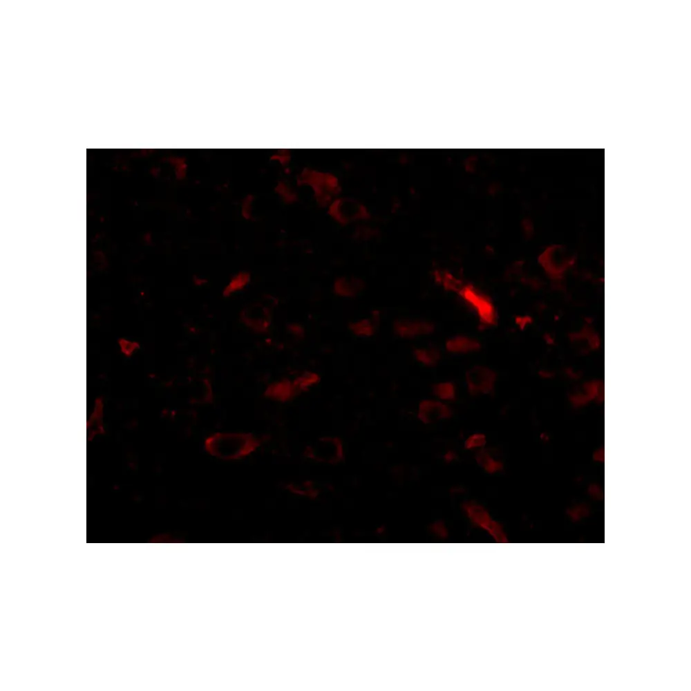 ProSci 5279 GALNT10 Antibody, ProSci, 0.1 mg/Unit Tertiary Image