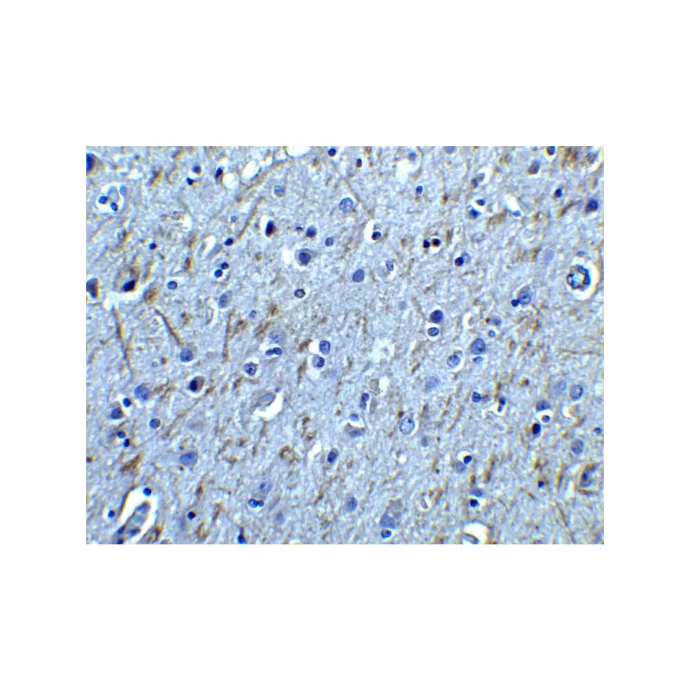 ProSci 1133_S GFR alpha 1 Antibody, ProSci, 0.02 mg/Unit Secondary Image