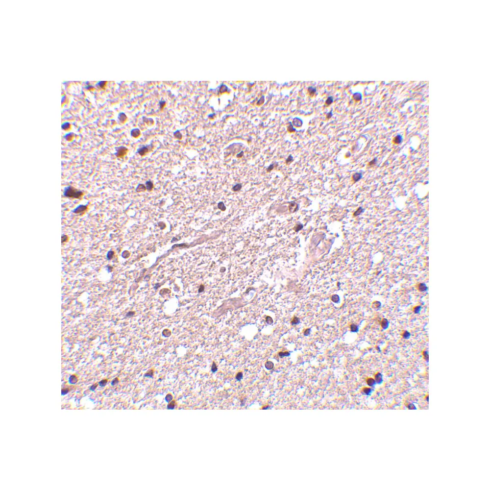 ProSci 4205_S HAP1 Antibody, ProSci, 0.02 mg/Unit Secondary Image