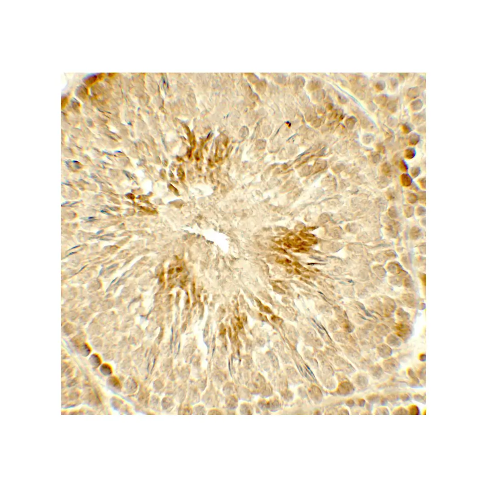 ProSci 7899_S HDAC2 Antibody, ProSci, 0.02 mg/Unit Secondary Image