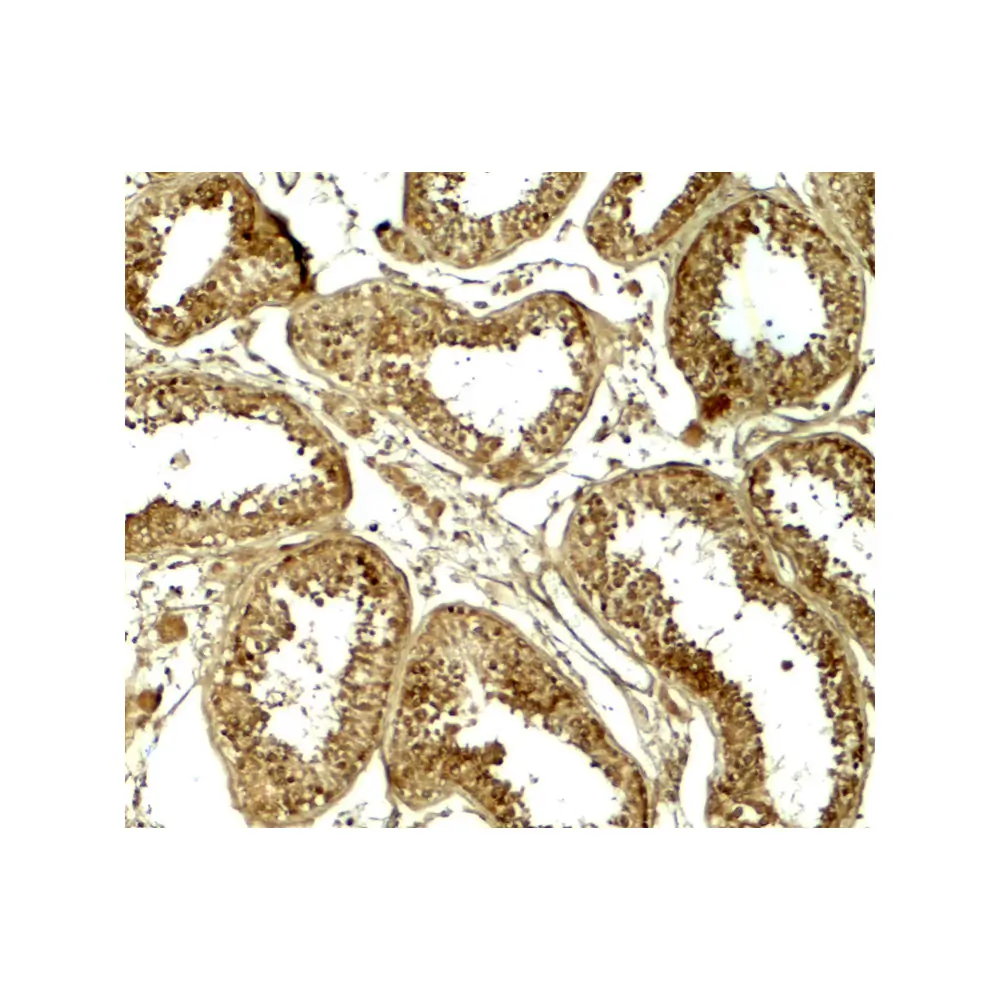 ProSci 7901_S HDAC6 Antibody, ProSci, 0.02 mg/Unit Secondary Image