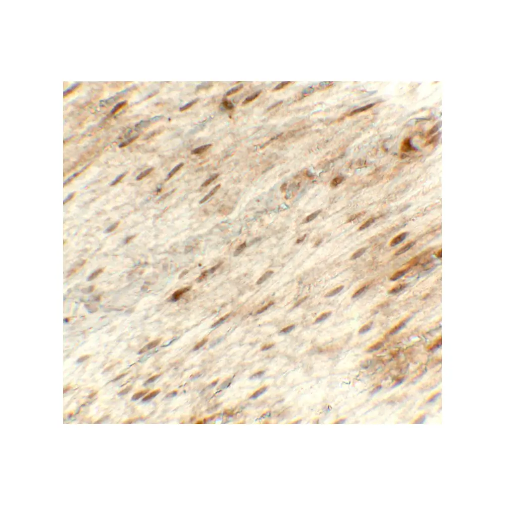 ProSci 8217 Hexokinase 1 Antibody, ProSci, 0.1 mg/Unit Secondary Image