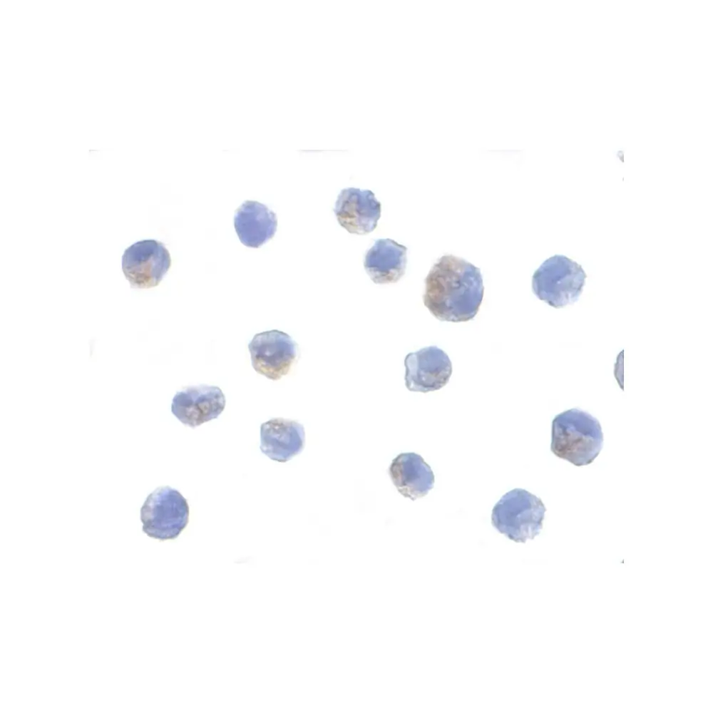 ProSci 2117 IKK alpha Antibody, ProSci, 0.1 mg/Unit Secondary Image
