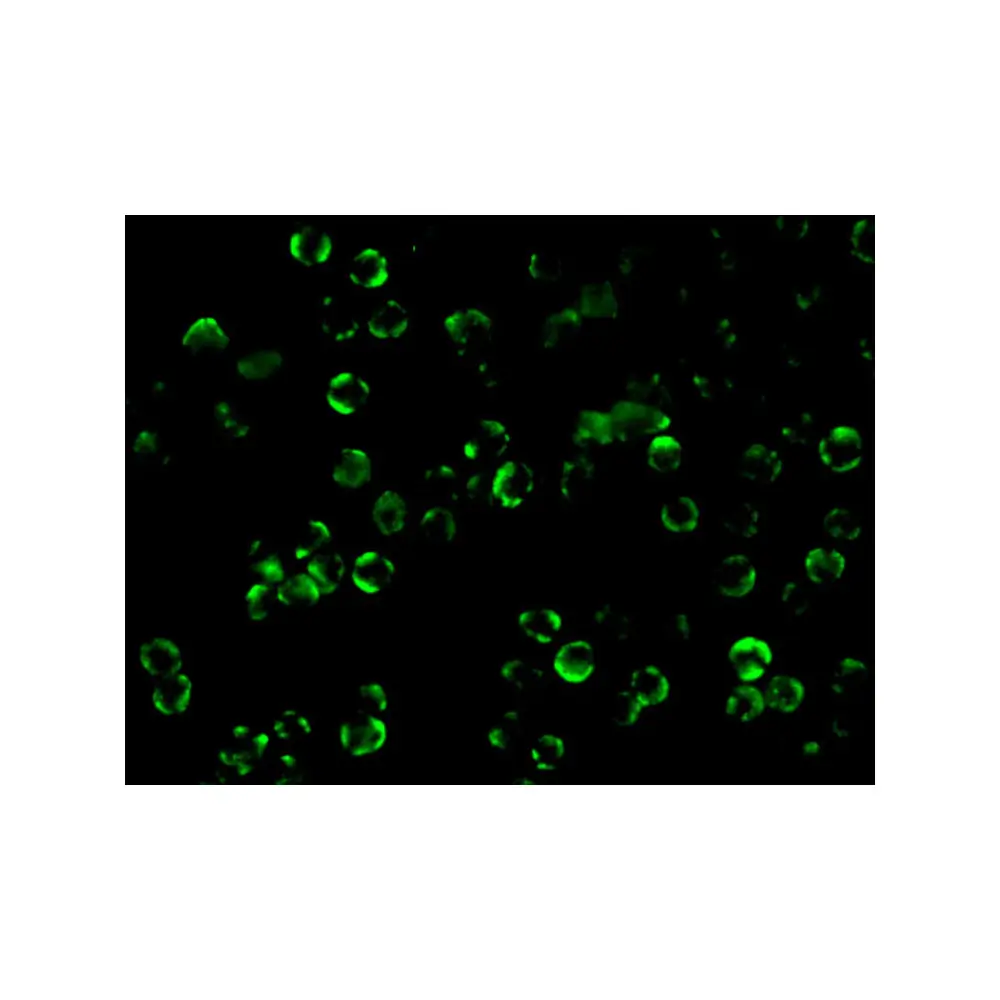 ProSci 2121_S IKK beta Antibody, ProSci, 0.02 mg/Unit Tertiary Image