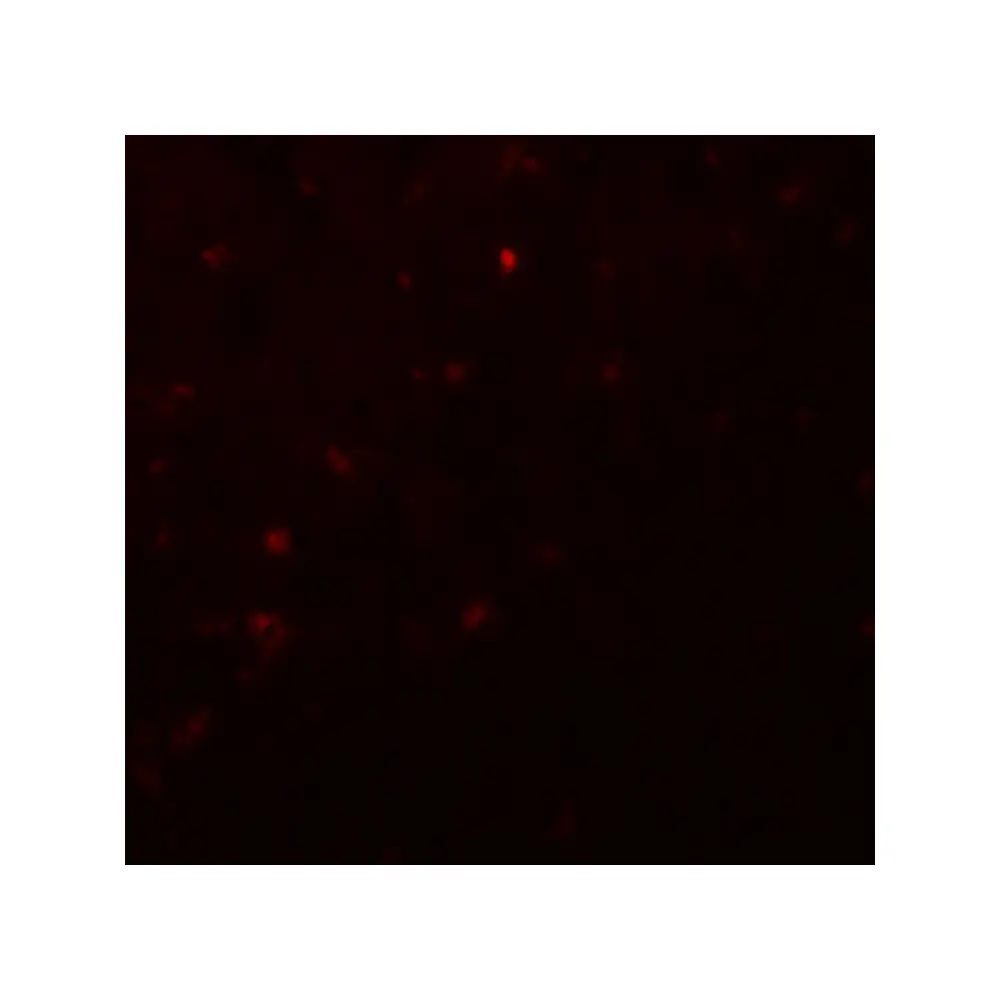 ProSci 8117 IKZF2 Antibody, ProSci, 0.1 mg/Unit Tertiary Image