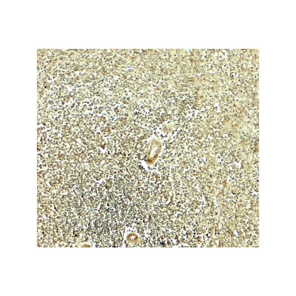 ProSci 8117 IKZF2 Antibody, ProSci, 0.1 mg/Unit Secondary Image