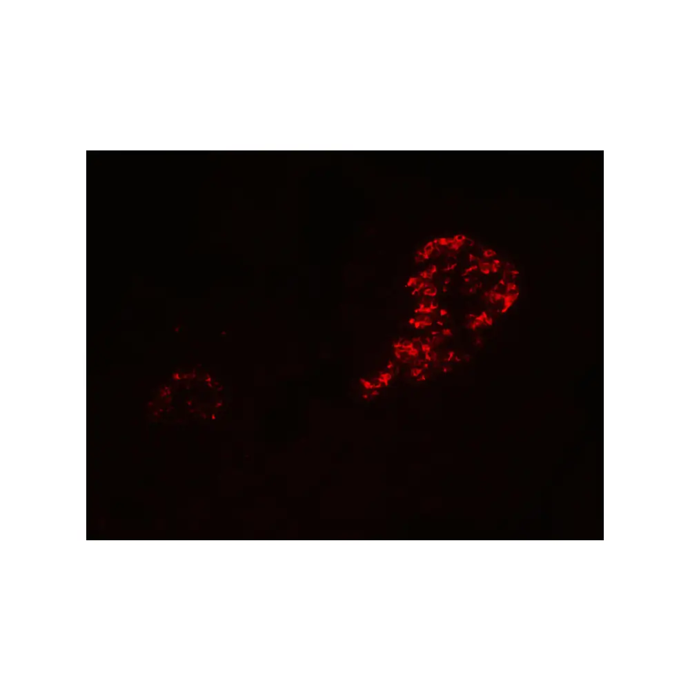 ProSci 7497 IL-12A Antibody, ProSci, 0.1 mg/Unit Tertiary Image