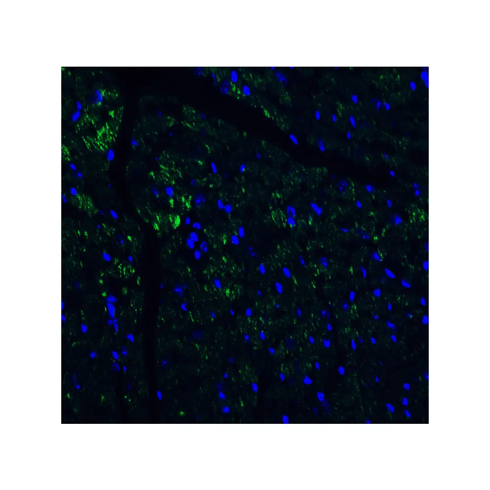 ProSci 4887 IL-17 Antibody, ProSci, 0.1 mg/Unit Quaternary Image
