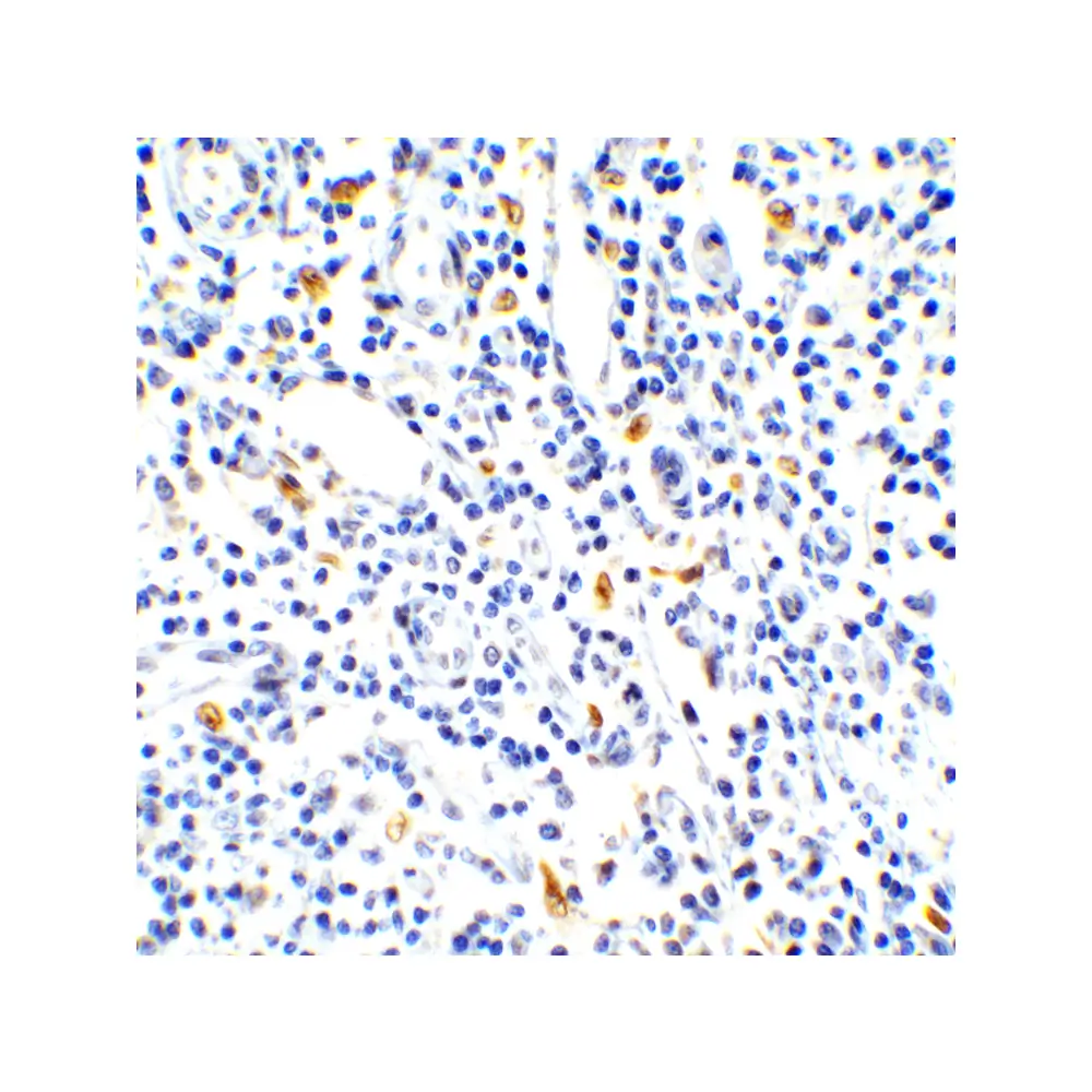ProSci 4887 IL-17 Antibody, ProSci, 0.1 mg/Unit Tertiary Image