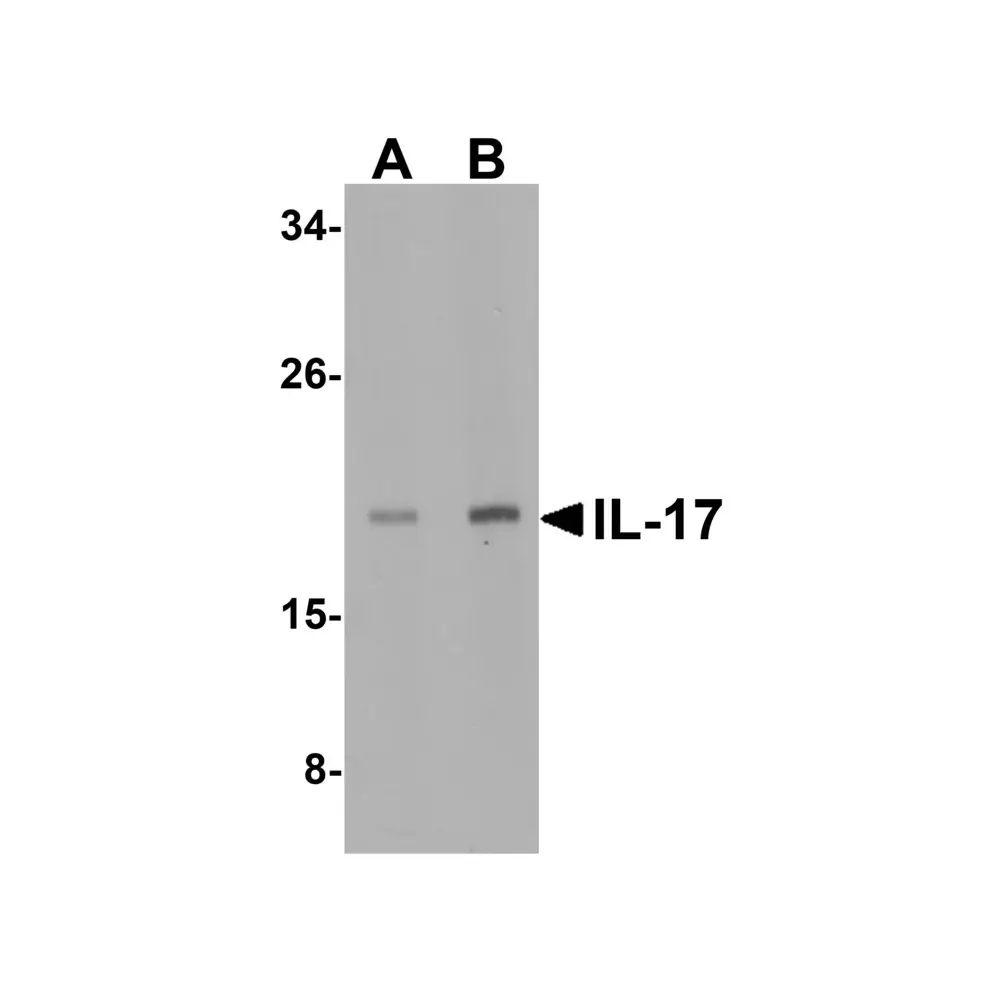ProSci 4877_S IL-17 Antibody, ProSci, 0.02 mg/Unit Secondary Image