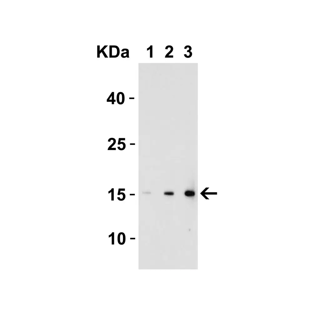 ProSci 4877_S IL-17 Antibody, ProSci, 0.02 mg/Unit Tertiary Image