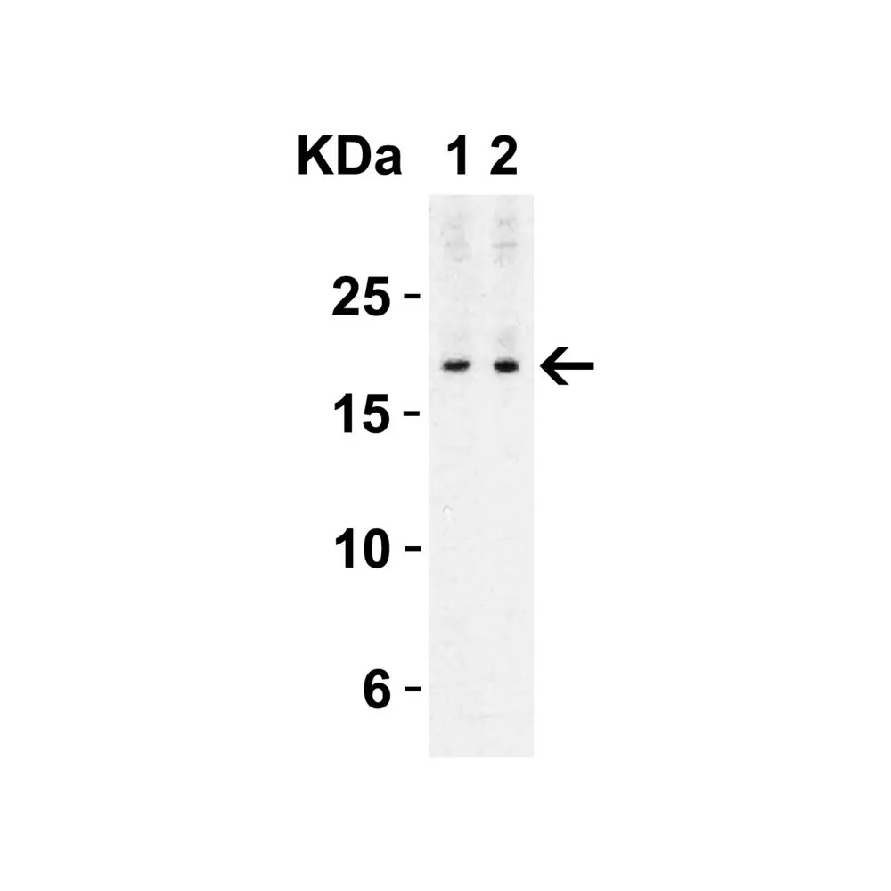 ProSci 4887 IL-17 Antibody, ProSci, 0.1 mg/Unit Secondary Image