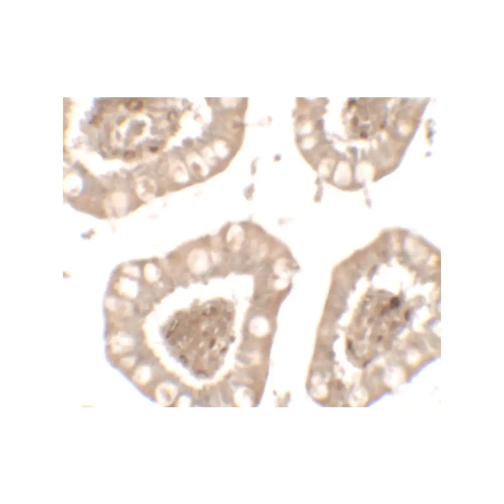 ProSci 7501 IL-1RL2 Antibody, ProSci, 0.1 mg/Unit Secondary Image