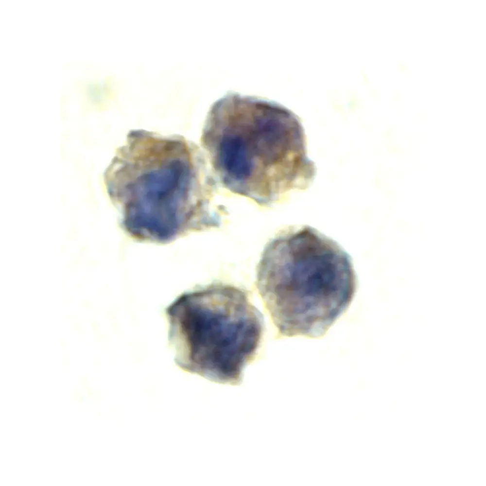 ProSci 2497_S IL-22 Receptor Antibody, ProSci, 0.02 mg/Unit Quaternary Image